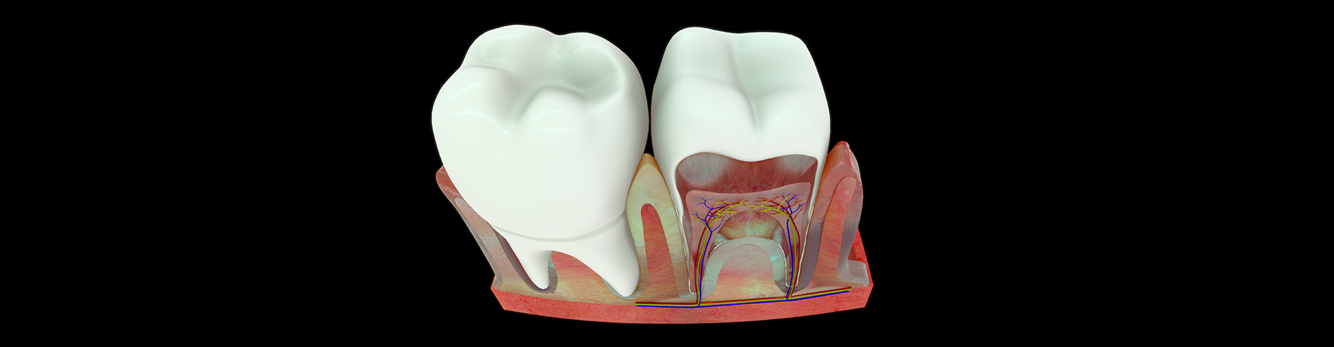rendering of a tooth with the anatomy exposed