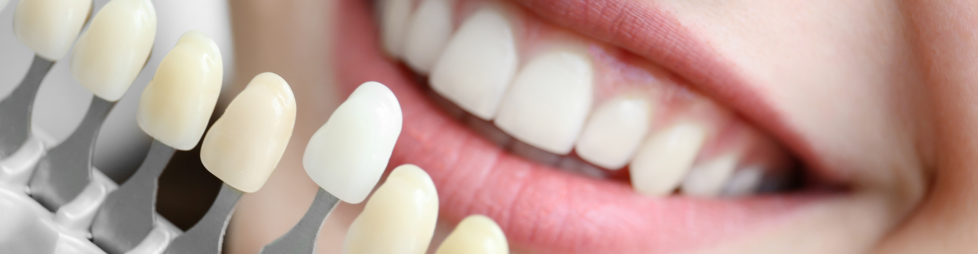 A woman smiling while holding a sample veneer in front of her teeth to check the ideal color.